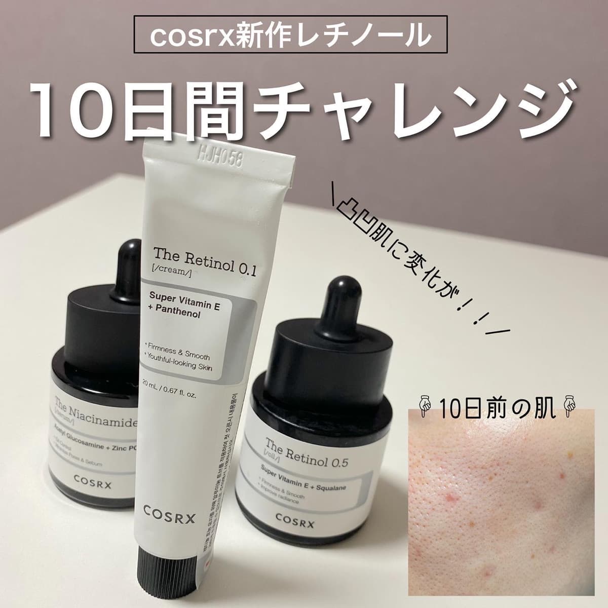 レチノール10日間チャレンジ！